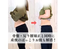 【産後骨盤矯正】産後整体でぽっこりお腹を改善♪ 保土ヶ谷/整体