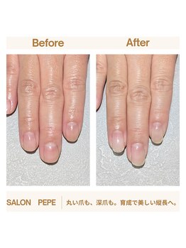 丸い・短い爪 Before→After