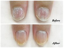 縦筋、爪の凸凹、甘皮の張り付きなどのお悩み解決！！