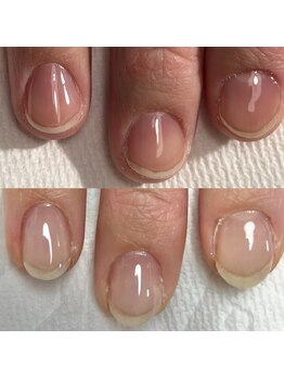 ハンド ケイ(Hand K)/自爪育成2ヶ月経過