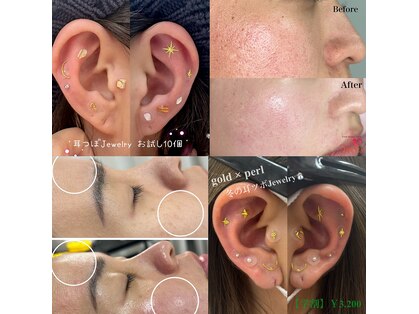 ヴィーナス(Venus)の写真