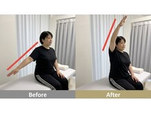 せなかのはね 難波心斎橋店/50代 肩こり 肩を上げると痛い