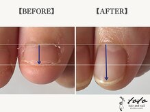 トトヘアー アンド ネイル(toto hair and nail)/【toto式】深爪育成ネイルケア