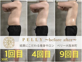 ペリー(PELLY)/男性30代　before after