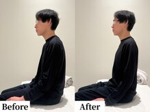 ソレア(Solea)/肩こり・巻き肩・首こり改善