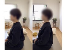 ランドル(rendre)/頭痛、くいしばり