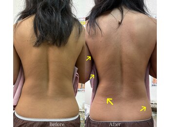 リラックスアンドビューティ(Relax&Beauty)/脂肪冷却2カップ