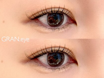 グランアイ(GRAN.eye)の写真