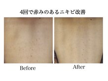 ナチュラーレ 天王寺店(Naturale)/美肌日焼けケア小顔ブライダル