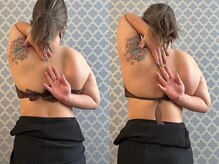 マイティー整骨院 ココア(CoCoa)/肩甲骨洗浄