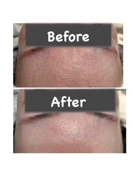 バイカラー(BY COLOR)/【毛穴洗浄】