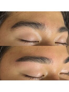 ルヴィ(Revi)/ハリウッドブロウリフト