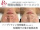 フェイシャルヴィム(FACIAL VIM)の写真