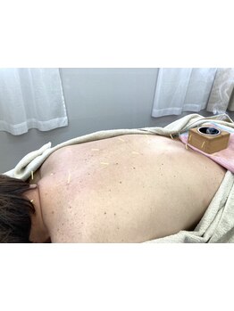 首・肩のつらさを改善したい