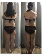 ミロク(369)/脂肪に徹底アプローチ