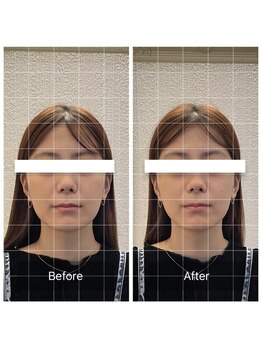 蒼月(aotsuki)/Before/After