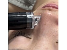 ラウレア(Laule'a)