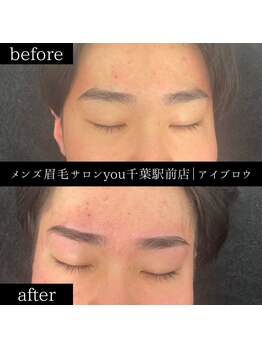 ユー 千葉駅前店(you)/ビフォ－アフター写真