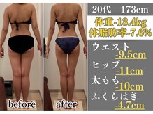 ラ コンシェル 町田店/Before After【町田店】