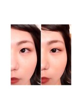 チャーミング(Charm Wink)/