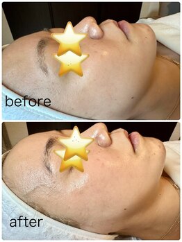 なまえのないエステサロン/クリスティーナ　アンストレス