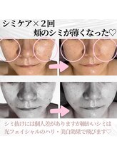 キー(kii)/シミケア30分