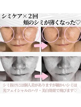 キー(kii)/シミケア30分