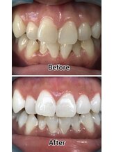 ドクターモック(Dr.MOC)/ＢＥＦＯＲＥ→ＡＦＴＥＲ