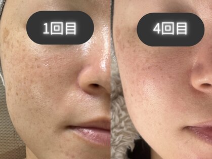 ライリー(Rairy)の写真