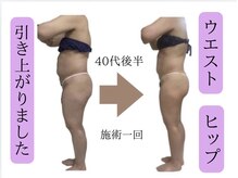 ナチュールファースト(naturel first)/セルゼロ比較写真