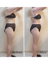 リブ 三軒茶屋(LiB)/骨格ケア＆セル脂肪痩身