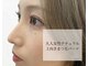 ルディア(Ludear)の写真