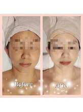 イーエムプレイス(EM;Place)/