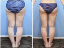 エピア 半田店(Epia)/自力では難しい下半身集中ケア