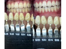 トウキョースワーズ 渋谷店(TOKYO SWRS)/#ホワイトニング #渋谷 #池袋