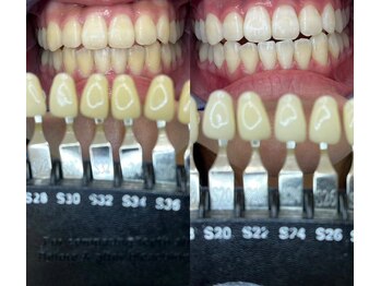 トウキョースワーズ 渋谷店(TOKYO SWRS)/#ホワイトニング #渋谷 #池袋