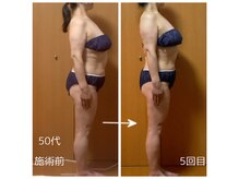 美ボディシェイプ（バザルト×痩身）