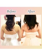 すばる整体院 小牧/ブライダル/姿勢矯正/小牧