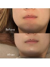 サロン ド モミカル(salon de momikaru)/