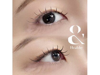 アクター(ACTOR)の写真