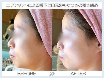 フェアリー(fairy)/