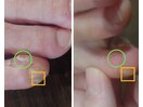 内側の胼胝、小爪(副爪)のケア