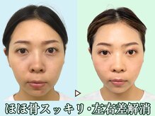 ナチュラルビューティーフェイス 横浜(NBF)/お化粧が楽になる/横浜駅