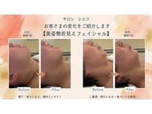 サロン シエラの雰囲気（あなたに合わせた施術と施術後のホームケアで結果をしっかり体感）