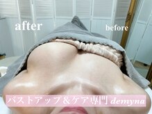 デミーナ(Demyna)/before→after