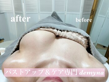 デミーナ(Demyna)/before→after