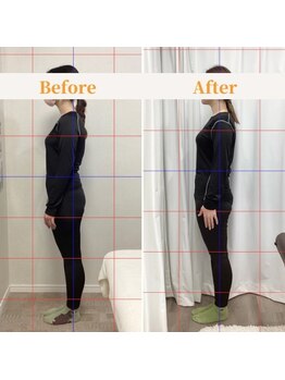 ルーム(Looom)/Before After