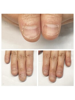 グレースレディ 神戸北店/