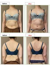 エステティック レイビス 銀座店(RAYVIS)/