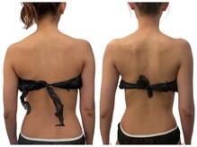 アンノン(Annon)/ブライダルエステ（BODY）